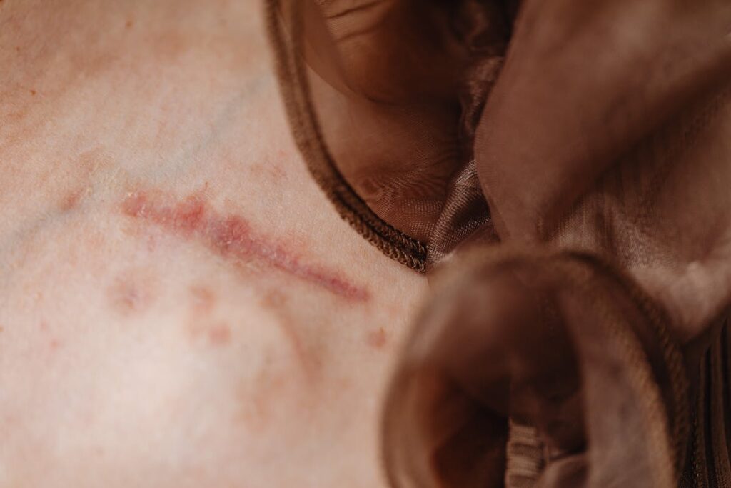 Close Up Shot of a Scar