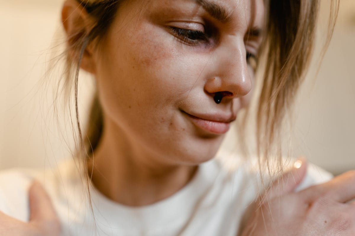 Close up of a Woman with Bruises on her Face
